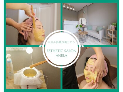 アネラ(ANELA)の写真