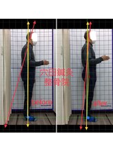 穴田鍼灸整骨院/整体・骨盤・ねこぜ・まき肩矯正