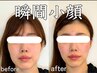【瞬間小顔】最短で小顔になりたい方はコチラがオススメ☆即効性重視☆