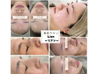 リアン(Lien)の写真