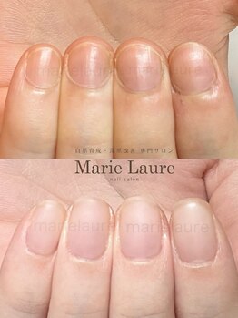 マリーロール 天王寺店(Marie Laure)/自爪育成/深爪矯正/ネイルケア