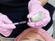 ナニワ ビューティー(naniwa beauty)の写真/はく離なしの次世代ピーリング！ダウンタイムなしの韓国艶肌！毛穴開き・リフトアップ効果も☆