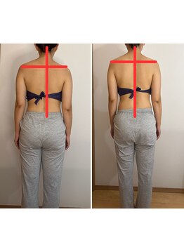 アイナ(Aina)/美姿勢＆肩こり改善