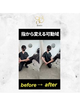 ルーツ(R∞ts)/指の施術で肩が変わることも！
