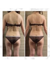 エムズ ビューティー サロン(M's Beauty Salon)/ビフォーアフター