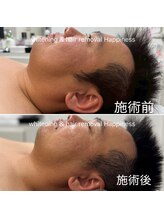 ハピネス 心斎橋アメリカ村本店(Happiness)/30代前半男性