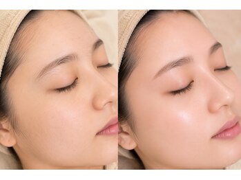エミー 梅田芝田店(Emie)の写真/【大人女性のトレンド×似合せ】フェイシャルワックス×アイブロウ×まつげパーマですっぴん美人へ★