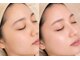 エミー 梅田芝田店(Emie)の写真/【大人女性のトレンド×似合せ】フェイシャルワックス×アイブロウ×まつげパーマですっぴん美人へ★