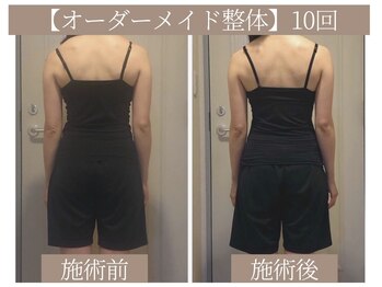 ドクターボディ 恵比寿店(Dr.Body)/【肩こり/首こり/肩甲骨/背中】