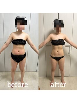 リノ ポノ(Lino Pono)/ビジリスとキャビテーション