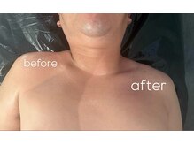 ラフェスタ ビューティー(Lafesta Beauty)/メンズコルギ