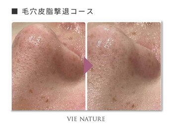 ヴィナチュール(vie nature)/ ■毛穴ケア