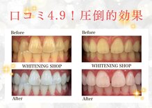 ホワイトニングショップ 府中店