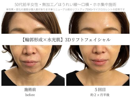 サボラミ(sabor A Mi)の写真