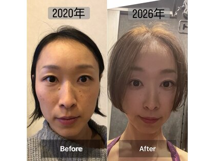 黄土よもぎ蒸しサロン 縁家の写真