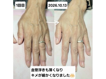 ネイルサロンカリプソ(Nail Salon Calypso 2)の写真