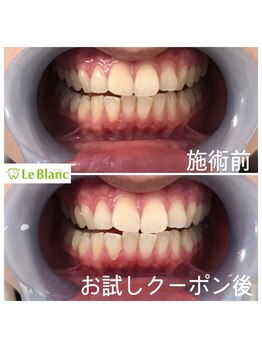 ルブラン 奈良店(Le Blanc)/いよいよです!!