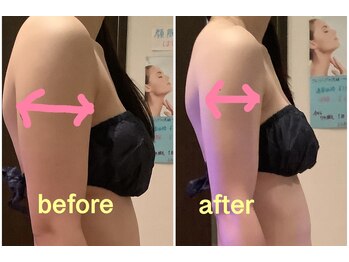 クレアボディ(CREA BODY)/二の腕