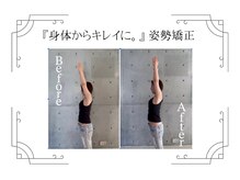 鍼灸整体院ユー(鍼灸整体院You...)/before/after