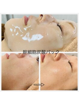 シロ(SHIRO)/幹細胞炭酸パック