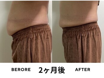 ゼロ(ZERO)/マグフォース☆before&after