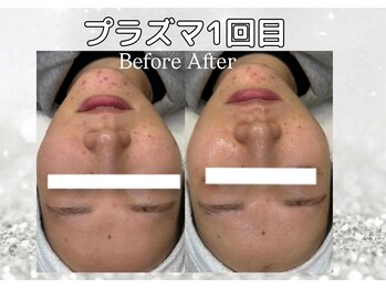 ハウピア 烏丸(Haupia)/【お肌の土台に栄養を届ける】