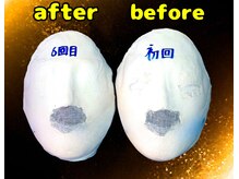 コルギサロン ベルエット(bell'et)/石膏パックのBefore Afterです☆
