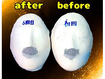 コルギサロン ベルエット(bell'et)/石膏パックのBefore Afterです☆