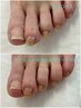 2回目以降　足爪ケアコース40分　5,800円