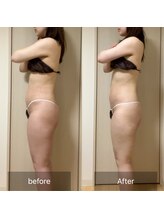 ココカラ(COCOKARA)/インディバ&アロマ痩身