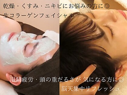 ビーグレイス(Vigrace)の写真