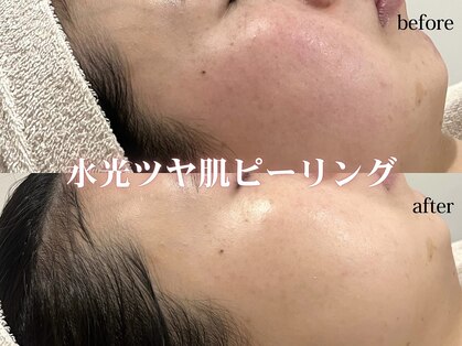 アディクトウラ(Addict'ula)の写真