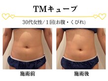 スパイア(SPIRE)/TMキューブ