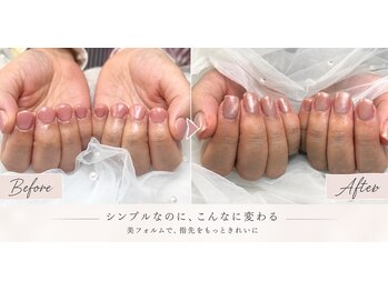 ミアリ(MIARI)の写真/爪のコンプレックスをそのままにしない。丁寧なケアと美フォルムで、思わず見せたくなる指先へ