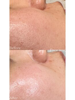 サロン リペ(Salon Lipe)/フェイスワックス