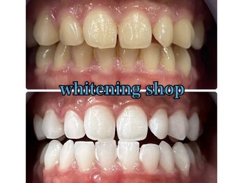 ホワイトニングショップ 静岡駅前店(WHITENING SHOP)