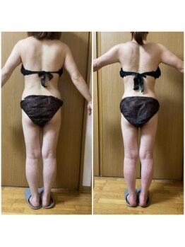 フィカス(FICUS)/本気で痩せたい方の味方!!