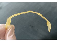 ミーミドットアイ(Mi-mi.i)/脱毛機よりワックス脱毛！！