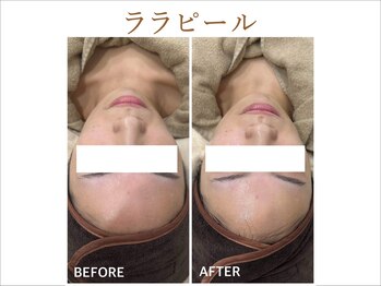 ティアム バイ テトテ 神戸三宮(TIAM by tetote)/ララピール