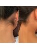 【部分脱毛一部位¥4,500】気になる部分だけお得に脱毛！