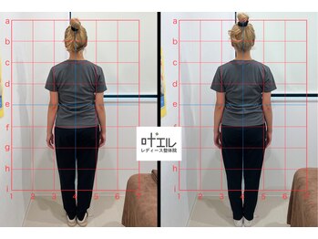 叶'エル 本町 心斎橋院/姿勢改善　骨盤矯正+猫背整体