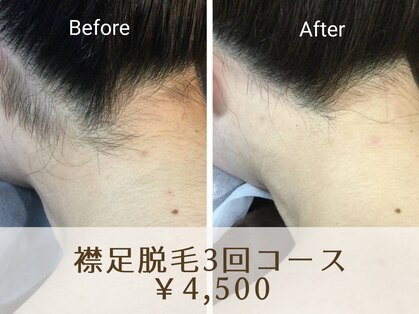 脱毛サロン ベル(Bell)の写真