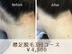 脱毛サロン ベル(Bell)の写真