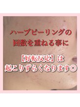 アルムダアクア 天王寺店(Aleumda AQUA)/ハーブピーリング/大阪/天王寺