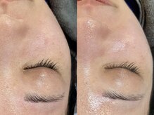 ビーマジック(Be Magic)/超保湿！毛穴洗浄