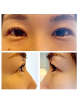 グロウビューティー(grow beauty)/