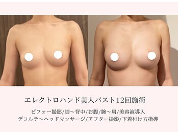 エイミー(Aimee)/バスト施術12回