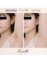 ルネル(Lunelle)/ノースリーブも怖くない♪