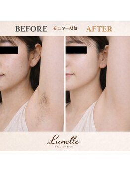 ルネル(Lunelle)/ノースリーブも怖くない♪