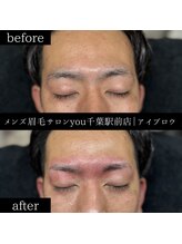 ユー 千葉駅前店(you)/ビフォ－アフター写真